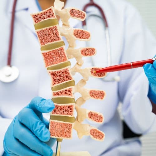 Osteoporosis: Bone Health, Fracture Prevention, and Supportive Care