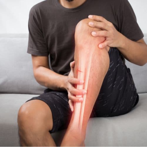 Post-Fracture Rehabilitation: From Immobilization to Functional Recovery